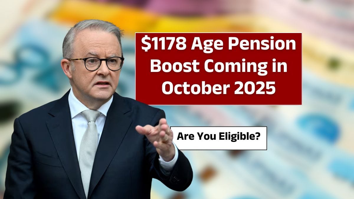 Anthony Albanese